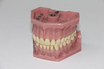 Системы имплантации зубов – фото 3