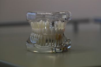 Протезирование зубов в стоматологии Медикастом  – фото 1