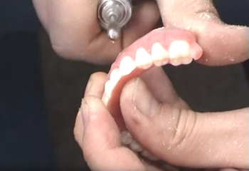 Сколько стоит протезирование зубов? – фото 1