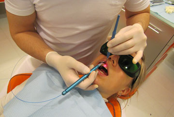 Лечение зубов лазером – фото 3
