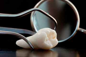 Удаление зубов в стоматологии Медикастом  – фото 2
