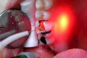 Клиника лазерной стоматологии – фото 3