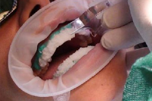 Клиника лазерной стоматологии – фото 4