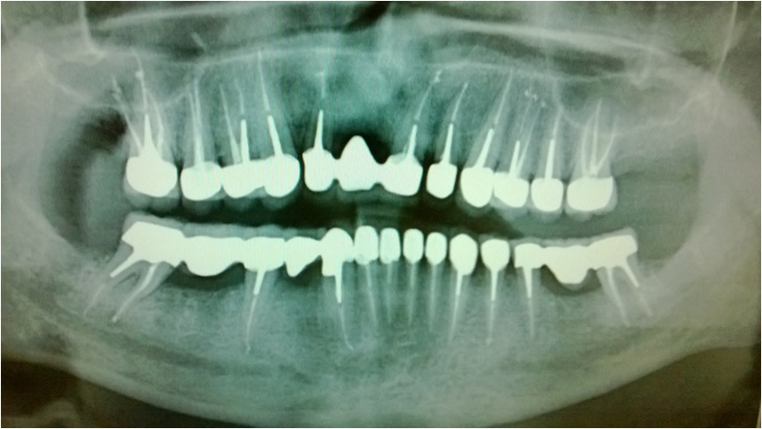 Ортопантомограмма зубов – фото 2